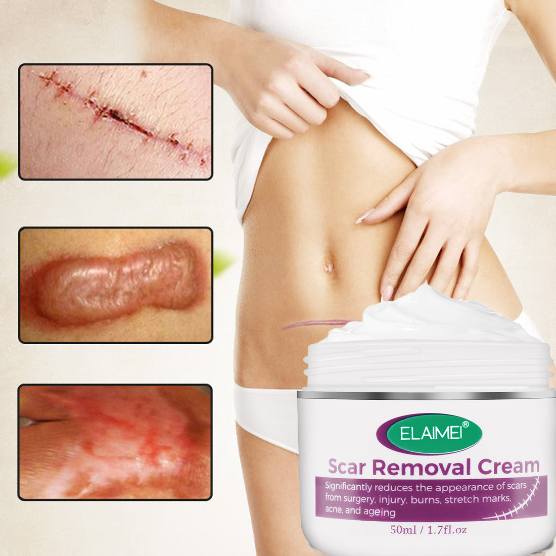 Scar Removal Cream Cream