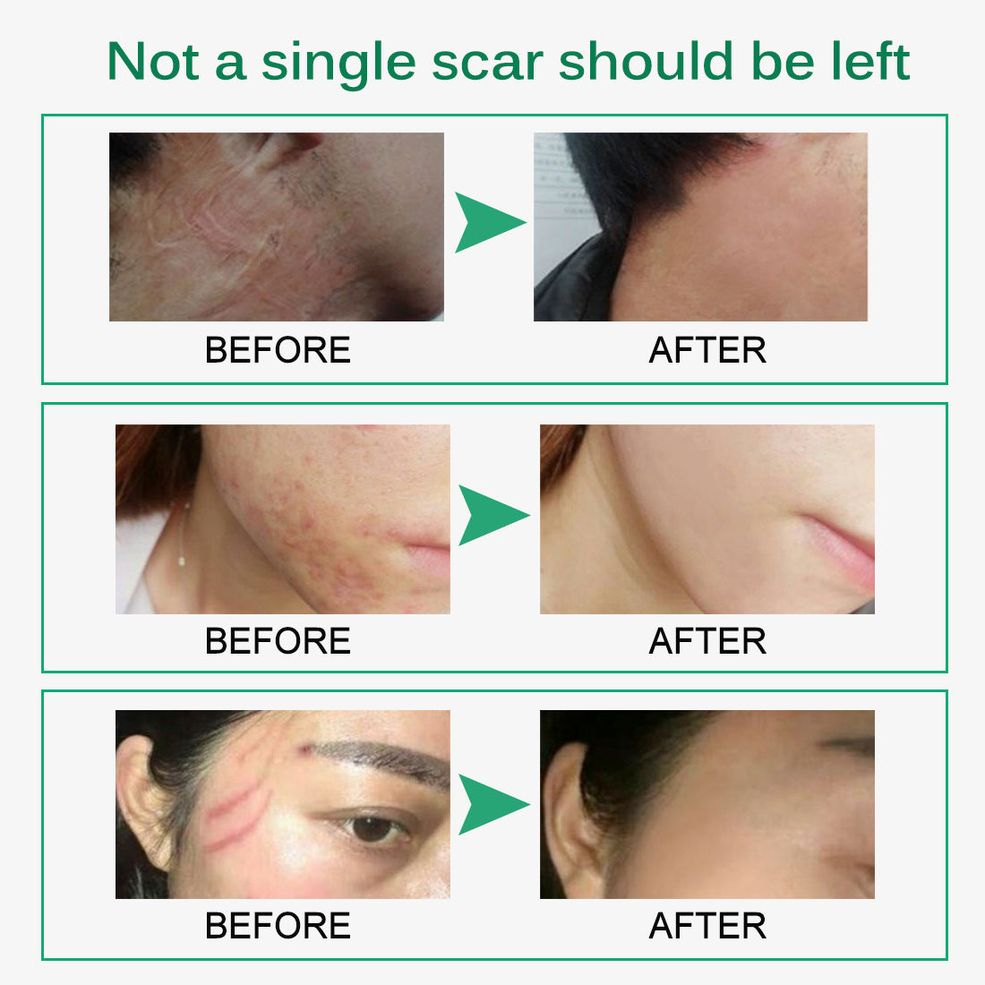 Scar Removal Cream Cream
