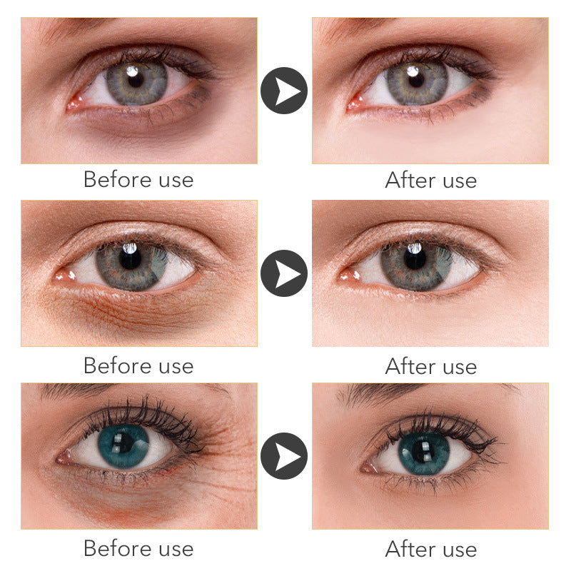 Eye Cream Women's Skin Care