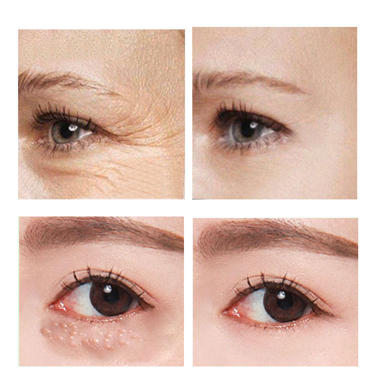 Eye Cream Women's Skin Care